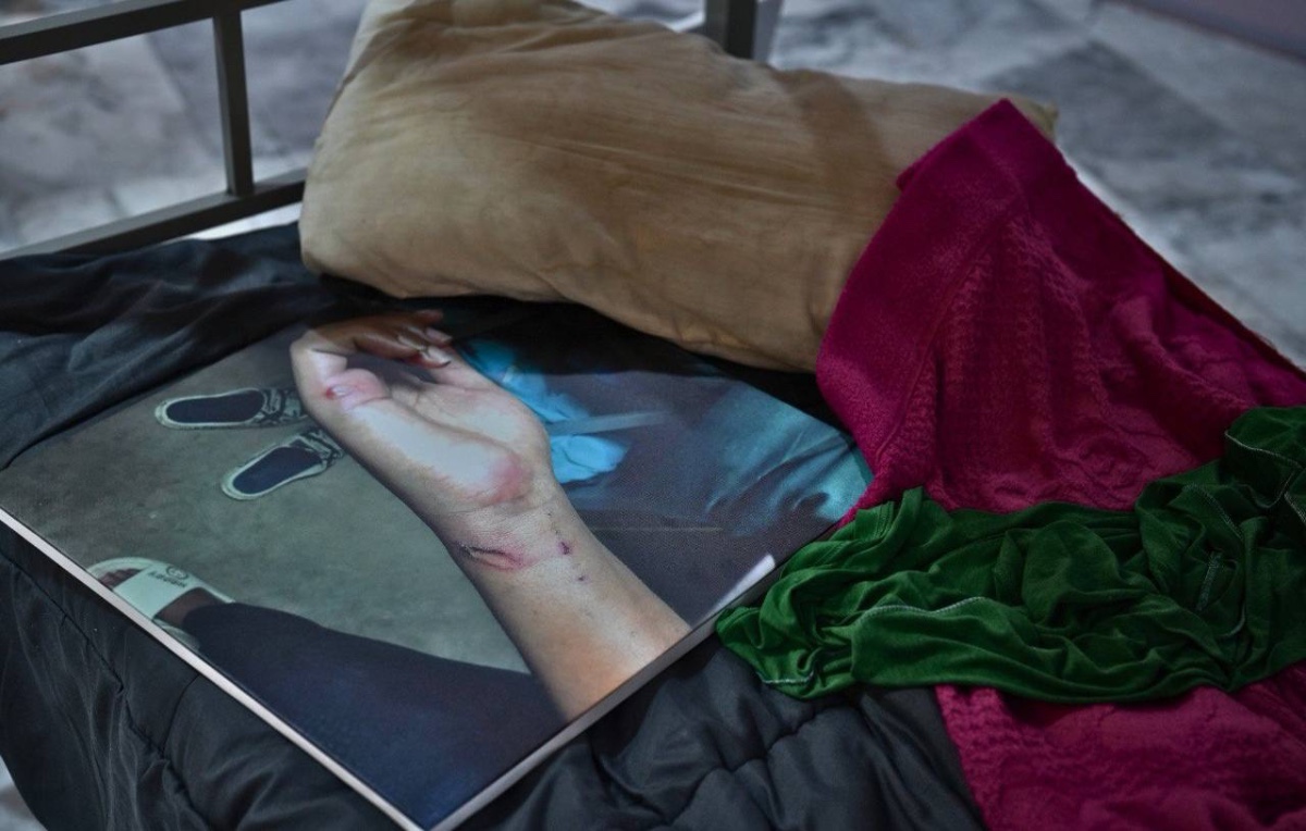 曼谷外国记者协会正在举办一场展览,讲述缅甸妙瓦底诈骗园区受害者遭遇的虐待